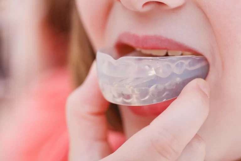 Sports Mouth Guards