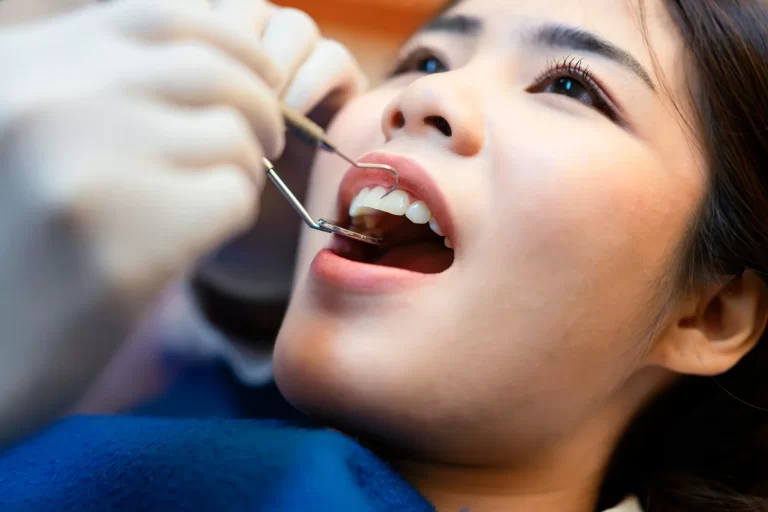 Fillings